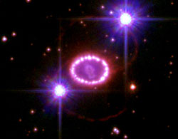 SN 1987 A