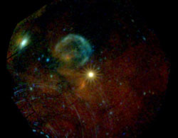 SN 1987 A